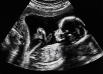 Babynieuws! Bij déze bekende familie is een baby op komst