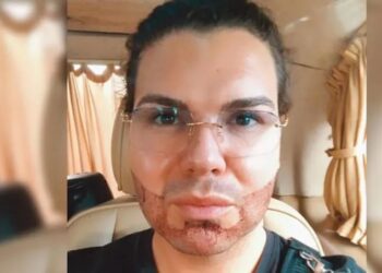 Roy Donders opnieuw in Turkije voor verbouwing: wat hij nu laat doen is echt bizar