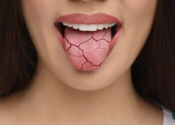 Verrassende redenen waarom je mond ’s nachts droog aanvoelt